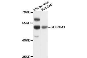 Western blot analysis of extracts of various cell lines, using SLC30A1 antibody. (SLC30A1 antibody)