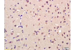 Formalin-fixed and paraffin embedded rat brain labeled with Rabbit Anti AKR1A1 Polyclonal Antibody, Unconjugated (ABIN872733) at 1:200 followed by conjugation to the secondary antibody and DAB staining (AKR1A1 antibody  (AA 53-130))