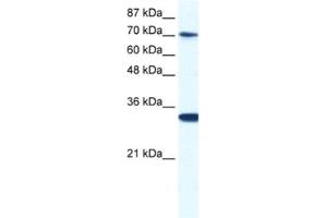 Western Blotting (WB) image for anti-CCR4-NOT Transcription Complex, Subunit 3 (CNOT3) antibody (ABIN2460917)