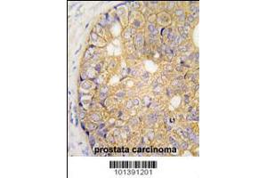 Immunohistochemistry (IHC) image for anti-Gap Junction Protein, beta 6, 30kDa (GJB6) (AA 87-117), (N-Term) antibody (ABIN5534072)