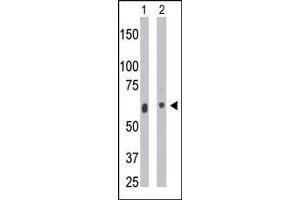 The anti-CERK Pab (ABIN391126 and ABIN2841252) is used in Western blot to detect CERK in mouse heart tissue lysate (Lane 1) and  cell lysate (Lane 2). (CERK antibody  (C-Term))