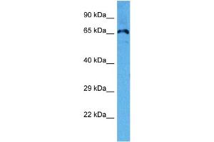 Host:  Mouse  Target Name:  KCND3  Sample Tissue:  Mouse Heart  Antibody Dilution:  1ug/ml (KCND3 antibody  (C-Term))