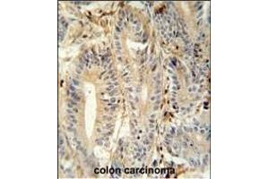 Immunohistochemistry (Paraffin-embedded Sections) (IHC (p)) image for anti-Meprin A, alpha (PABA Peptide Hydrolase) (MEP1A) (AA 149-175), (N-Term) antibody (ABIN652039)