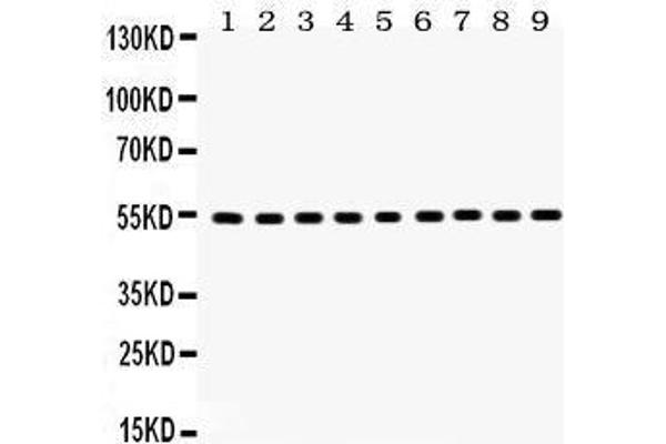 Vimentin antibody  (C-Term)