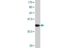 Western Blot detection against Immunogen (37. (Tachykinin 3 antibody  (AA 17-121))