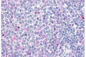 Anti-P2RY10 / P2Y10 antibody  ABIN1049203 IHC staining of human spleen, lymphocytes.