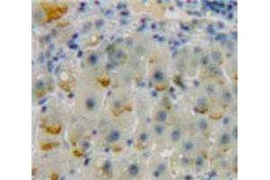 Used in DAB staining on fromalin fixed paraffin-embedded Liver tissue (ADCY9 antibody  (AA 1029-1282))