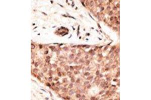 Image no. 2 for anti-Caudal Type Homeobox 2 (CDX2) (N-Term) antibody (ABIN358610) (CDX2 antibody  (N-Term))
