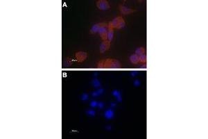 Expression of TRPV6 in PC-3 cells - Immunocytochemical staining of paraformaldehyde-fixed PC-3 cells with Anti-TRPV6 Antibody (ABIN7043857, ABIN7043998 and ABIN7043999), (1:100) followed by goat anti-rabbit-AlexaFluor-555 secondary antibody (A) or with a mixture of Anti-TRPV6 Antibody and TRPV6 peptide antigen (1:20) (B). (TRPV6 antibody  (Intracellular))