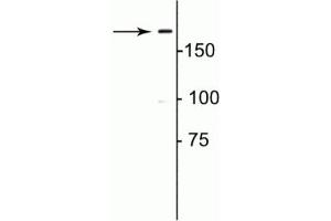 Western blot of rat lung lysate showing specific immunolabeling of the ~180 kDa collagen 1. (COL1A1 antibody)