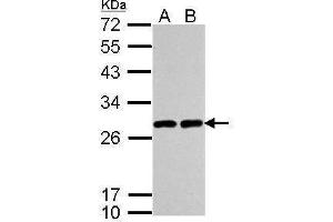 WB Image Sample (30 ug of whole cell lysate) A: A549 B: H1299 12% SDS PAGE antibody diluted at 1:5000 (UCHL1 antibody  (C-Term))
