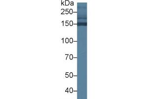 Detection of COL2a1 in Mouse Serum using Polyclonal Antibody to Collagen Type II Alpha 1 (COL2a1) (COL2A1 antibody  (AA 1307-1383))