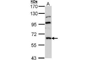 WB Image Sample (30 ug of whole cell lysate) A: Hep G2 7. (MGAT3 antibody)