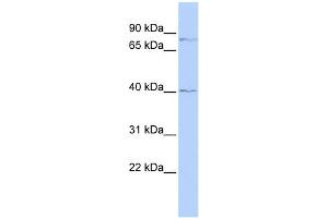 WB Suggested Anti-ZNF214 Antibody Titration:  0.