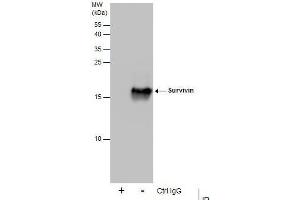 IP Image Immunoprecipitation of Survivin protein from 293T whole cell extracts using 5 μg of Survivin antibody, Western blot analysis was performed using Survivin antibody, EasyBlot anti-Rabbit IgG  was used as a secondary reagent.