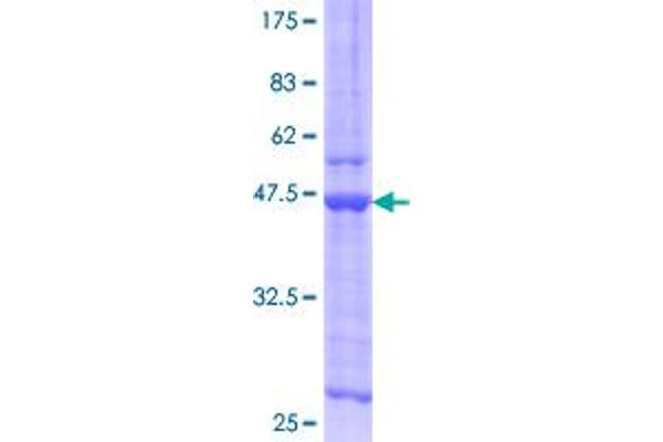 Chemerin Protein (AA 17-163) (GST tag)