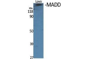 Western Blot (WB) analysis of specific cells using MADD Polyclonal Antibody. (MADD antibody  (Internal Region))