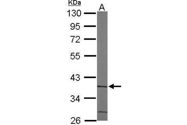 ACMSD antibody