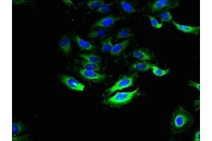 Immunofluorescent analysis of Hela cells using ABIN7170032 at dilution of 1:100 and Alexa Fluor 488-congugated AffiniPure Goat Anti-Rabbit IgG(H+L) (SLC28A1 antibody  (AA 1-80))