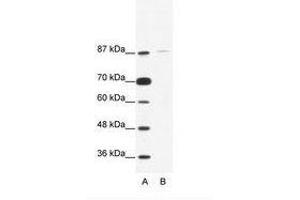 Image no. 1 for anti-TATA Box Binding Protein (TBP)-Associated Factor, RNA Polymerase I, C, 110kDa (TAF1C) (C-Term) antibody (ABIN203252)