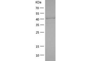 SERPINA5 Protein (AA 20-406) (His tag)