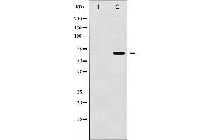Western blot analysis of Chk2 phosphorylation expression in Jurkat whole cell lysates,The lane on the left is treated with the antigen-specific peptide. (CHEK2 antibody  (pThr387))
