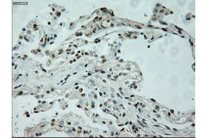 Image no. 2 for anti-L1 Cell Adhesion Molecule (L1CAM) antibody (ABIN1499089)