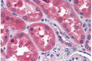 Human Kidney: Formalin-Fixed, Paraffin-Embedded (FFPE) (TWIST2 antibody  (AA 1-161))