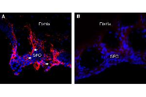 Expression of Aquaporin 4 in rat subfornical organ (SFO).