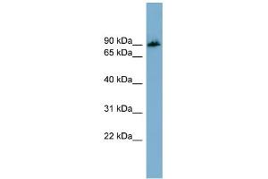 WB Suggested Anti-APBB1IP Antibody Titration: 0. (Amyloid beta (A4) Precursor Protein-Binding, Family B, Member 1 Interacting Protein (APBB1IP) (N-Term) antibody)