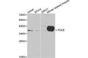 Western blot analysis of extracts of various cell lines, using POLB antibody (ABIN5970839) at 1/1000 dilution. (POLB antibody)