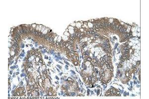Image no. 1 for anti-Retinoic Acid Receptor Responder (Tazarotene Induced) 3 (RARRES3) (AA 51-100) antibody (ABIN321114) (RARRES3 antibody  (AA 51-100))