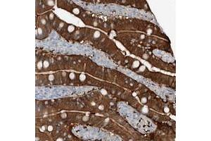 Immunohistochemical staining of human duodenum with ANKRD34A polyclonal antibody  shows strong cytoplasmic and membrane positivity in glandular cells.