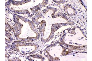 IHC analysis of Calpastatin using anti-Calpastatin antibody . (Calpastatin antibody  (Middle Region))