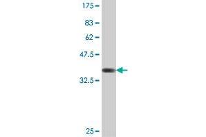 Western Blot detection against Immunogen (37. (CLIC3 antibody  (AA 137-236))