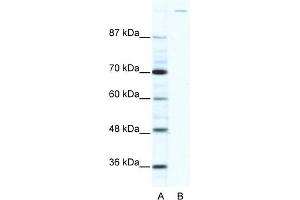 WB Suggested Anti-GLI1 Antibody Titration:  2.