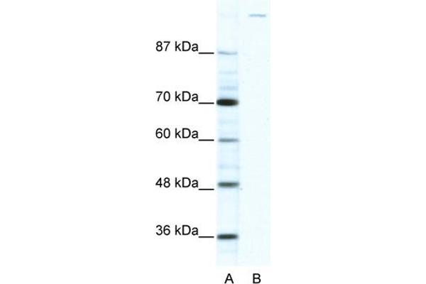 GLI1 Antikörper  (C-Term)