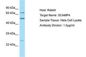 Image no. 1 for anti-Secretory Carrier Membrane Protein 4 (SCAMP4) (C-Term) antibody (ABIN6750133) (SCAMP4 antibody  (C-Term))