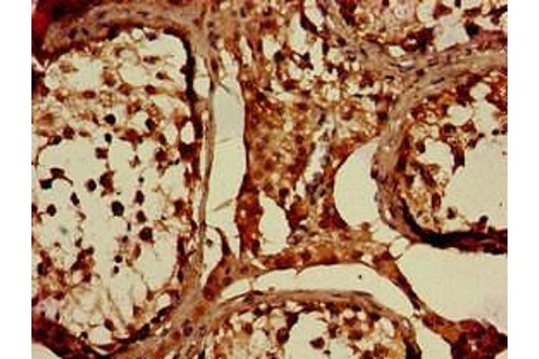 WNK1 antibody  (AA 1-207)