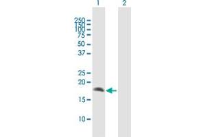 Western Blot analysis of CRYGD expression in transfected 293T cell line by CRYGD MaxPab polyclonal antibody. (CRYGD antibody  (AA 1-174))