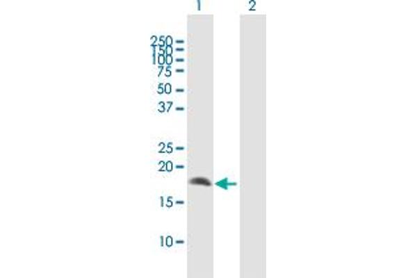 CRYGD anticorps  (AA 1-174)