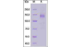SARS-CoV-2 S1 protein, Fc Tag on  under reducing (R) condition.