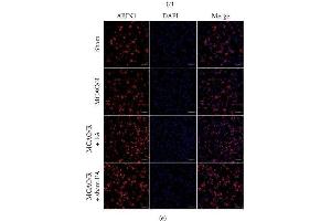 ABIN1 expression in the peri-infarct area at different time points. (TNIP1 antibody)
