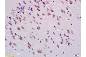 Formalin-fixed and paraffin embedded rat brain labeled with Anti-Smoothened/SMO Polyclonal Antibody, Unconjugated  at 1:200, followed by conjugation to the secondary antibody and DAB staining