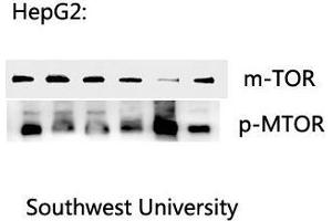 Western Blotting (WB) image for anti-Mechanistic Target of Rapamycin (serine/threonine Kinase) (mTOR) (pSer2448) antibody (ABIN6282465)