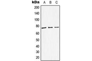 Western blot analysis of Dopamine beta Hydroxylase expression in HEK293T (A), SP2/0 (B), NIH3T3 (C) whole cell lysates. (DBH antibody  (Center))