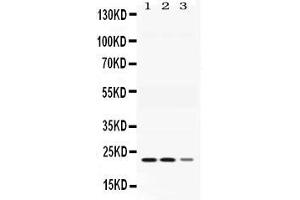 Western blot analysis of Adenylate Kinase 1 expression in rat skeletal muscle extract ( Lane 1), mouse cardiac muscle  extract ( Lane 2) and COLO320 whole cell lysates ( Lane 3). (Adenylate Kinase 1 antibody  (C-Term))
