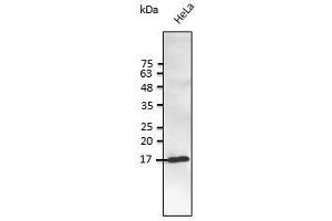 Anti-SNCG Ab at 1/2,500 dilution, lysate at 50 µg per Iane, rabbit polyclonal to goat lgG (HRP) at 1/10,000 dilution, (SNCG antibody  (C-Term))
