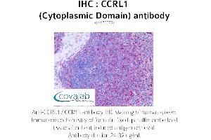 Image no. 1 for anti-Chemokine (C-C Motif) Receptor-Like 1 (CCRL1) (2nd Cytoplasmic Domain) antibody (ABIN1732791) (CCRL1 antibody  (2nd Cytoplasmic Domain))