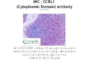 Image no. 1 for anti-Chemokine (C-C Motif) Receptor-Like 1 (CCRL1) (2nd Cytoplasmic Domain) antibody (ABIN1732791)